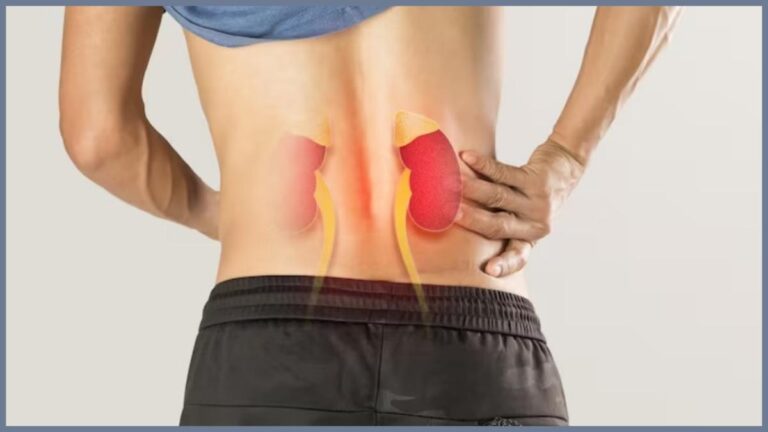 ESWL and Kidney Stones